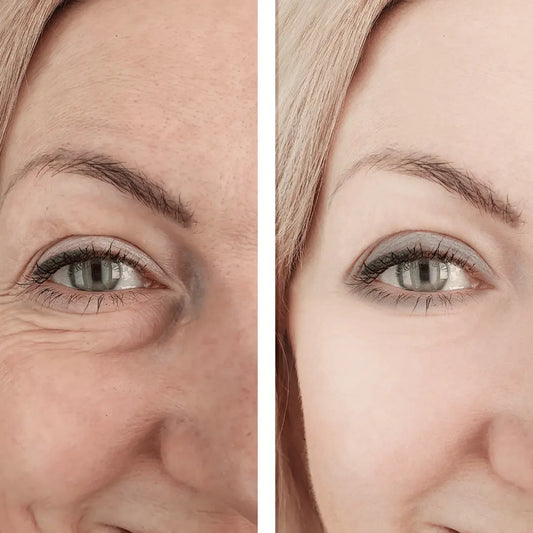 Anti-Aging