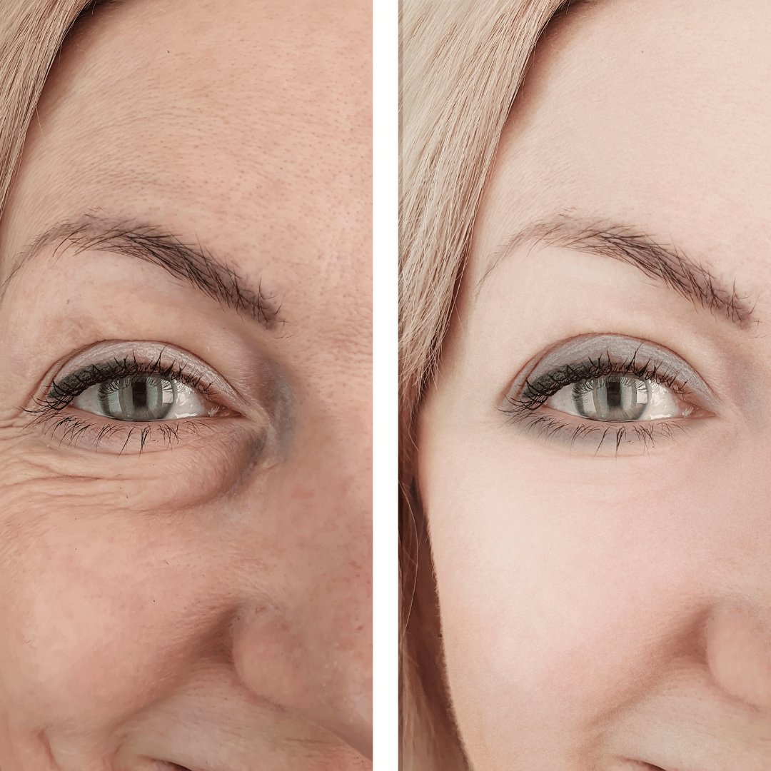 Anti-Aging