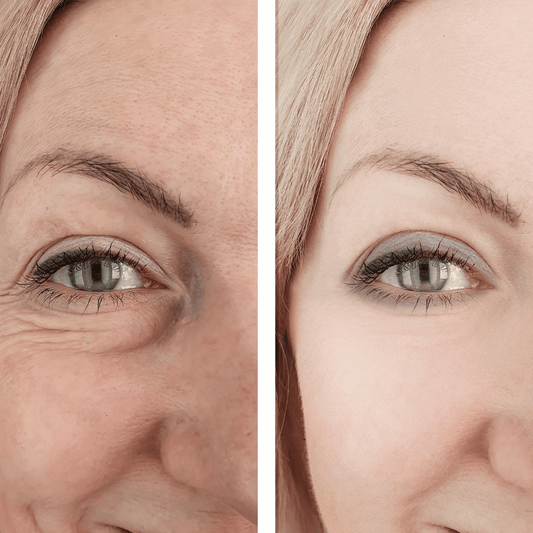 Anti-Aging