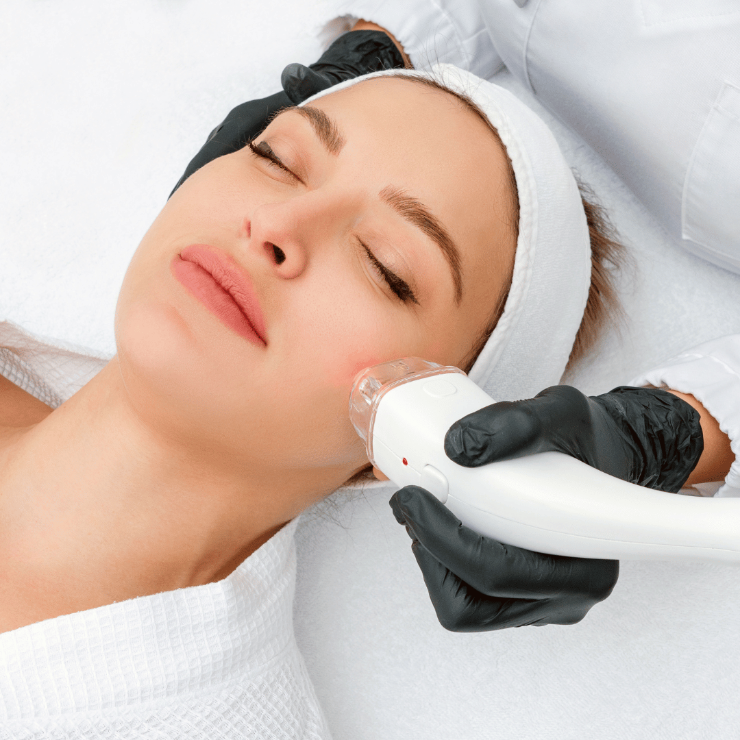 IPL hair removal