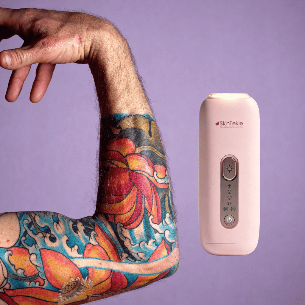 IPL on Tattooed Skin